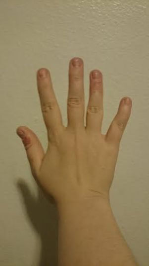 Right hand 1-22-16 15 months